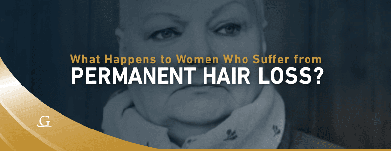 Woman With Permanent Hair Loss Stock Photo