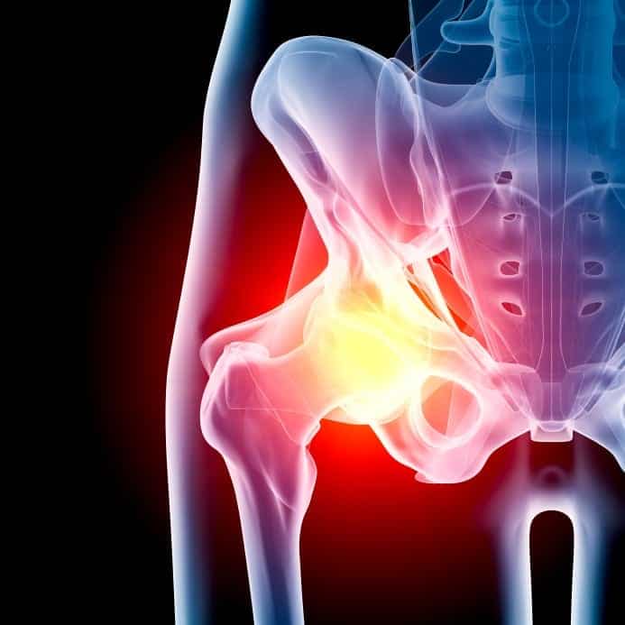 Hip Skeleton Stock Photo