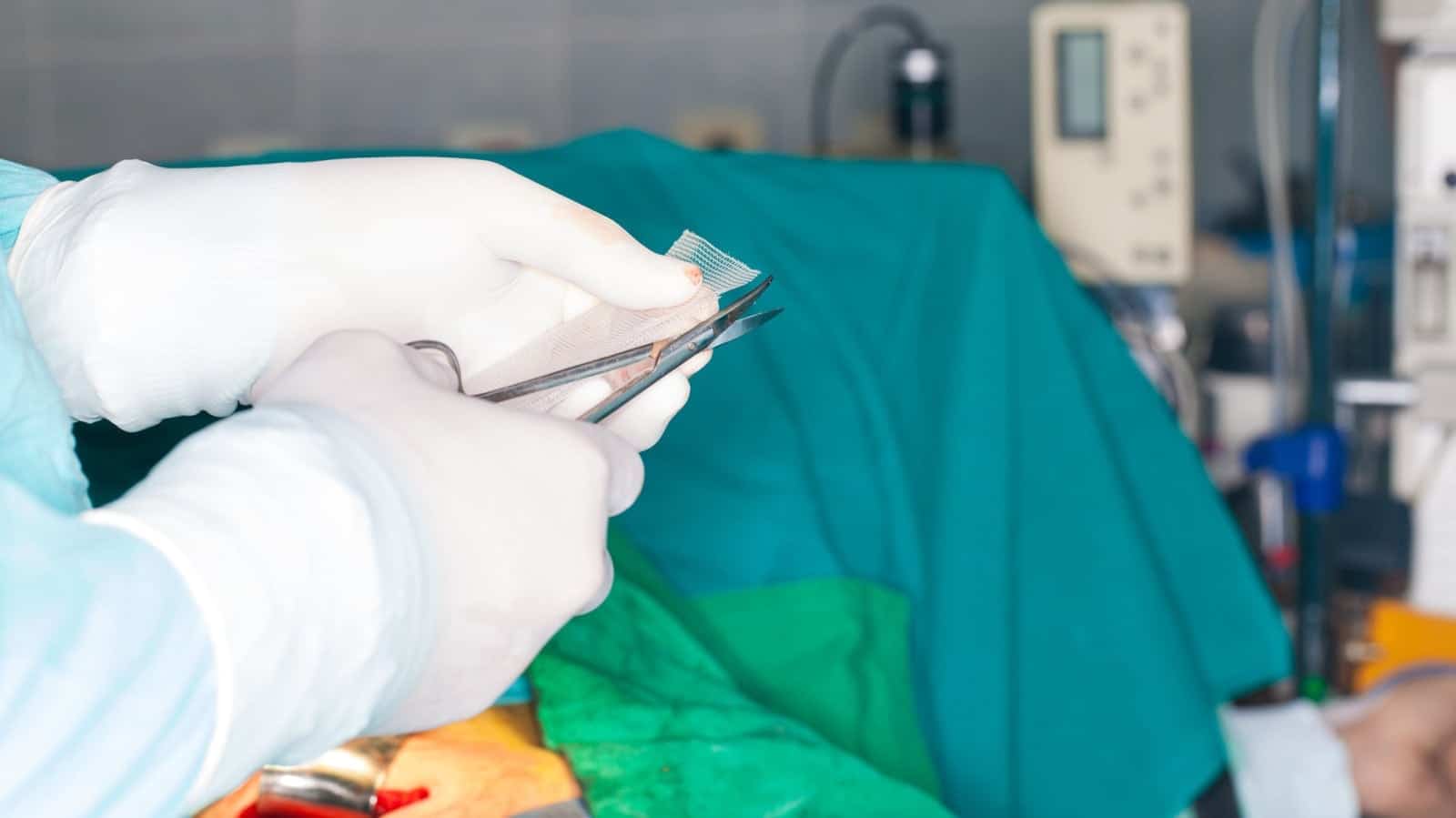 surgeon chops mesh for hernia