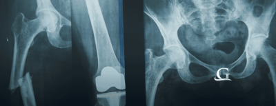 Medical X-ray Stock Photo