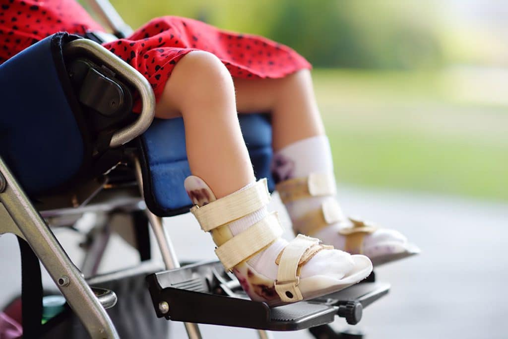 child with cerebral palsy after suffering a birth injury in Arizona