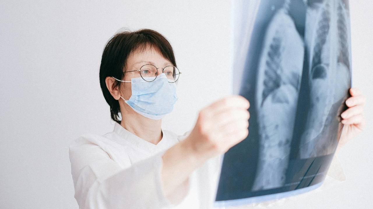 What Is the Average Settlement for Asbestos Lung Cancer